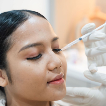 Botox Allergan 9