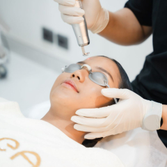 Face Laser Treatment 14