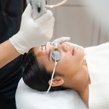 Face Laser Treatment 7