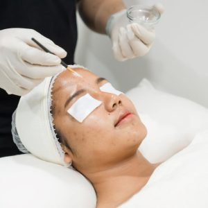 Face Peeling 2 (1)